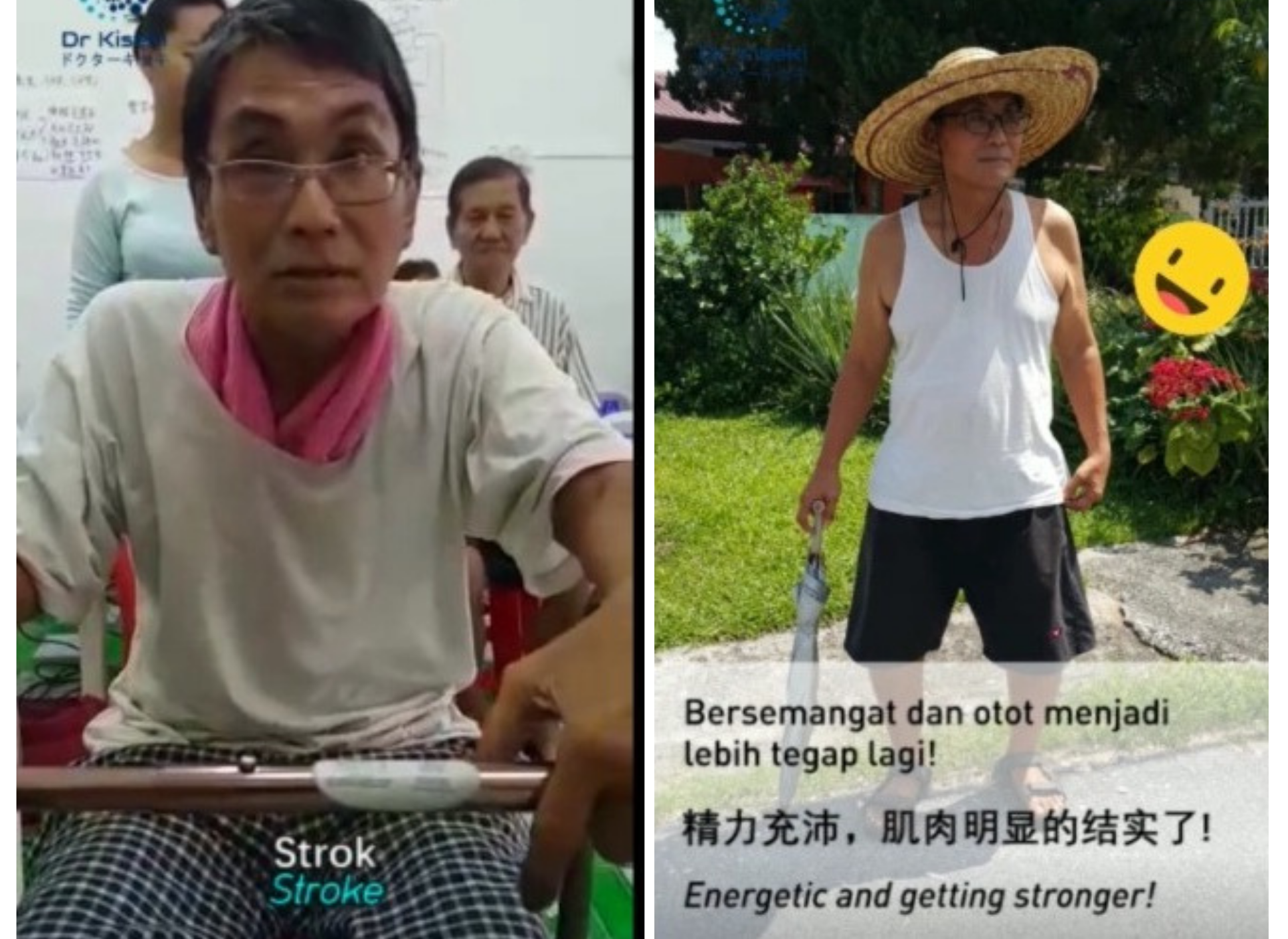 Real user testimonial – Mark sharing his experience using the Dr Kiseki home therapy device to support mobility after stroke in Malaysia